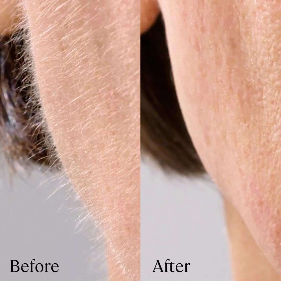 Michael Todd Beauty Sonicsmooth Pro+ Dermaplane Razor Blade Refills | 8 Dermaplaning Blades, 2 Month Supply, Device Not Included - Image 5