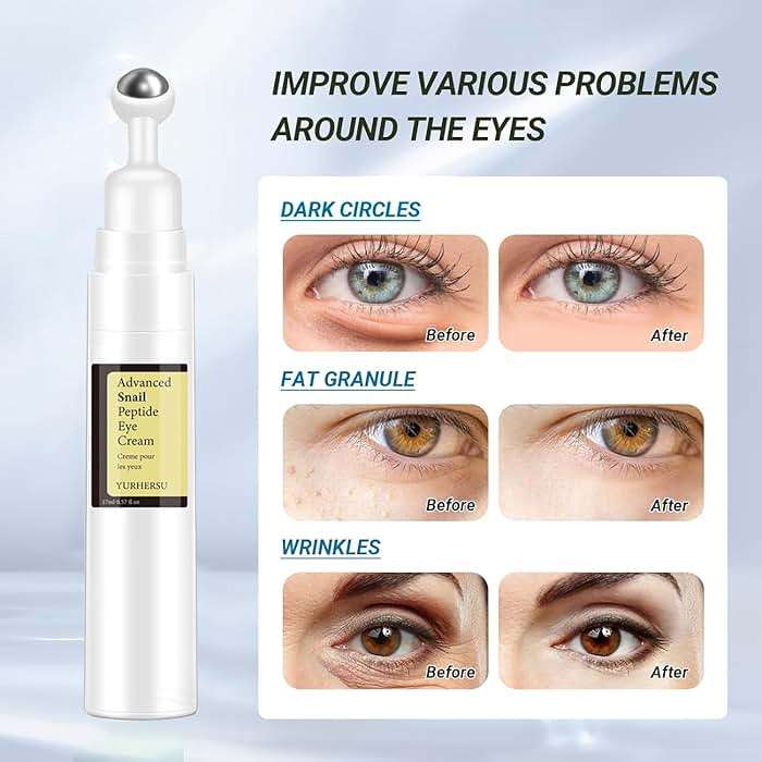 ELCHHIRSCH Snail Peptide Under Eye Cream with 73% Snail Mucin & 2% Nicotinamide for Dark Circles, Puffiness & Wrinkles, with 360° Massaging Roller Ball, 0.57 fl oz - Image 5