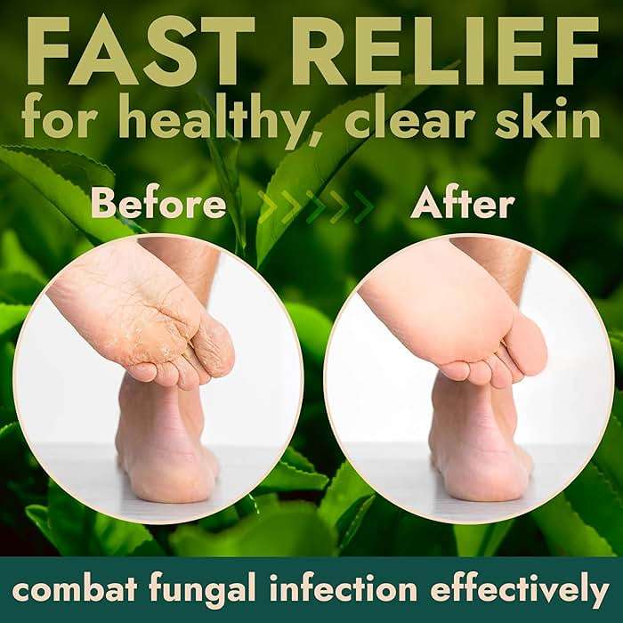 Foot Scrub with Tea Tree Oil | Callus Remover For Feet | Exfoliating Scrub with Salicylic and Glycolic Acid for Dead Skin, Athlete’s Foot, Warts, Corns, Rashes, Foot Odor, Insect Bites and Foot Care - Image 4