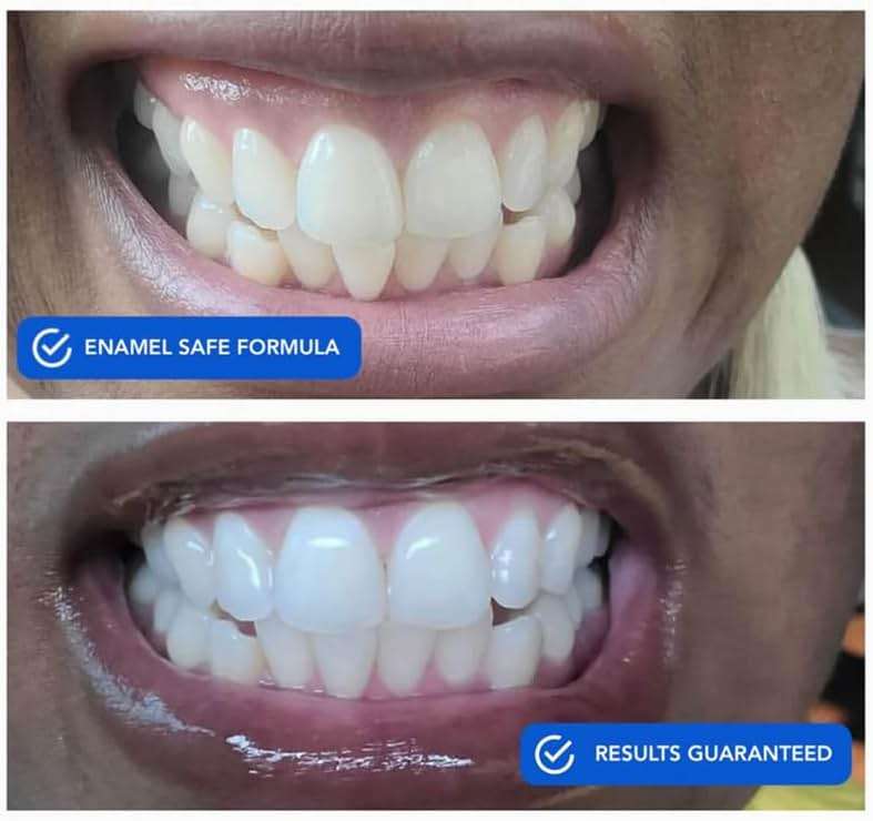 SNOW Teeth Whitening Strips 14 Count | Dissolving Formula with Hydrogen Peroxide and Hydroxyapatite | for Coffee Wine and Tea Stains | No Peel No Rinse | Fluoride Free - Image 3