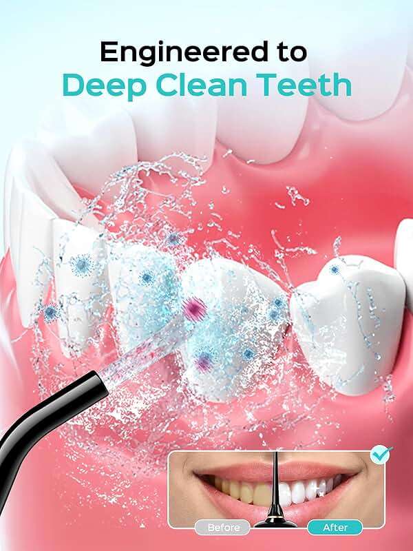 COSLUS E40 Portable Water Flosser for Teeth: ADA Accepted, 10 Pressure Settings Professional Water Dental Pick for Orthodontic, Braces & Sensitive Gums - Cordless for Travel Use, for Teens, BPA-Free - Image 2