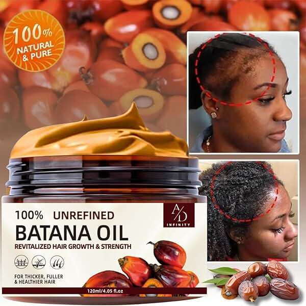 100% Unrefined Raw Batana Oil for Hair Growth Dr. Sebi Organic Pure from Honduras with Keratin, Coffee Extract & Other Ingredients to Enhance Efficacy for Thicker, Strength - Botana Oil 4oz - Image 2