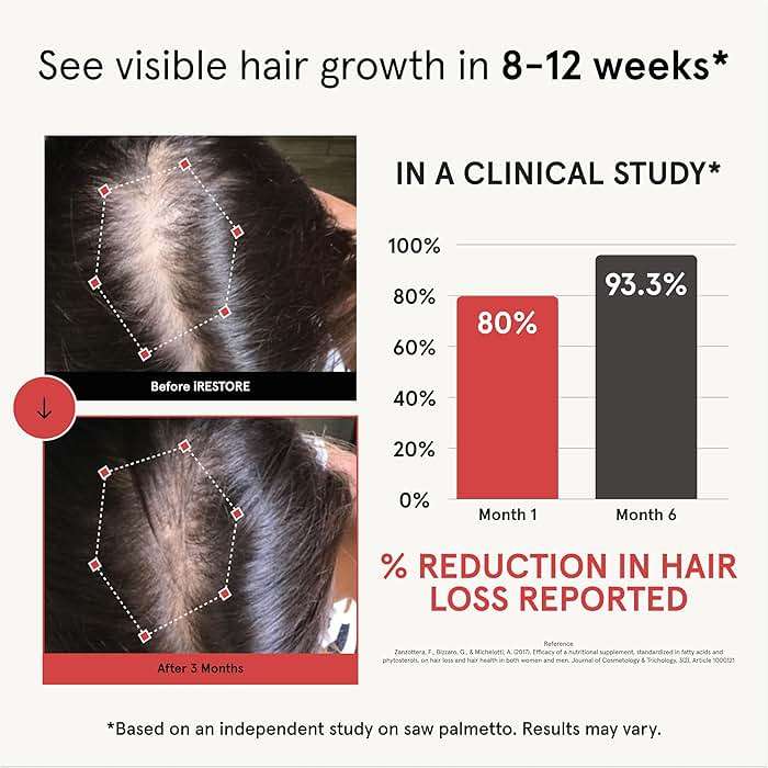 iRestore Hair Growth Supplement - Hair Loss Vitamins for Women and Men - Biotin Multivitamins & DHT Blocker to Reduce Hair Thinning - Hair Regrowth Pills - 30 Days Supply 90 Count (Pack of 1) - Image 2