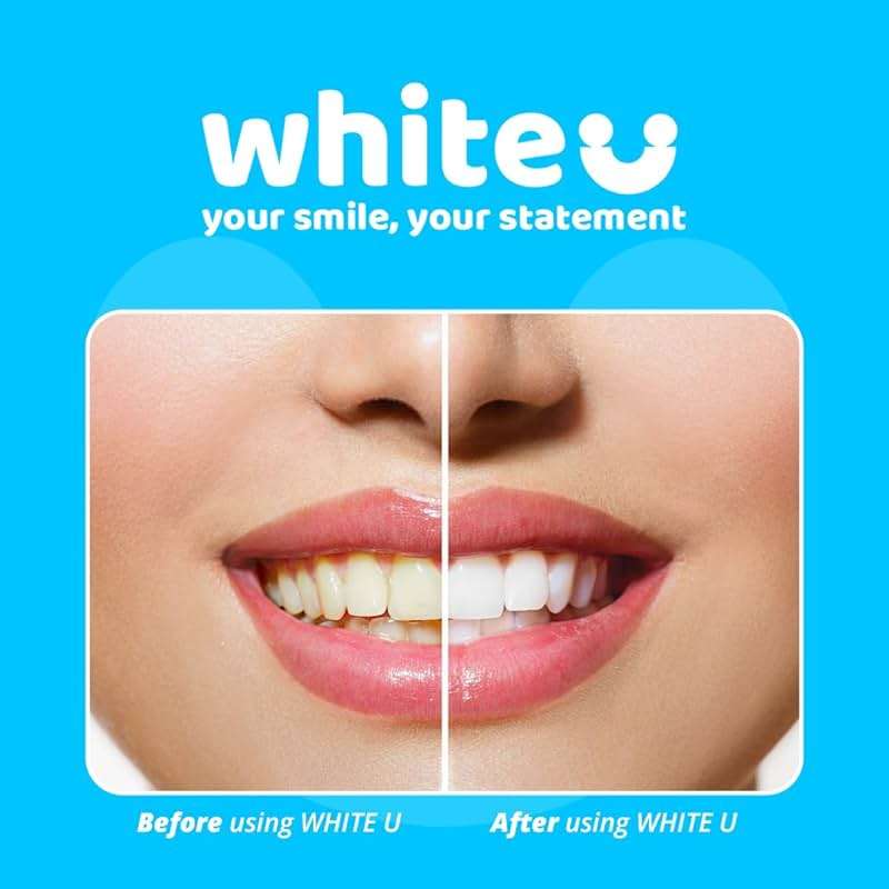 Teeth Whitening Strips for Sensitive Teeth - Peroxide Free No Sensitivity - 14 Strips with Pap+ & Nano Hydroxyapatite - Enamel Safe Whitening in 7 Days - WhiteU - Image 3