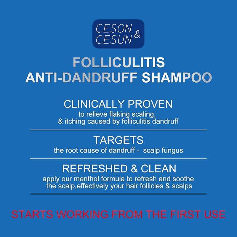 Ceson&Cesun Anti-Fungal/Anti Dandruff 2 in 1 Shampoo for Folliculitis, Scalp Psoriasis & Seborrheic Dermatitis, Itchy & Dry Scalp Relief, Nourishes, Hydrates, Fresh Scent, Safe For Color-Treated Hair - Image 2