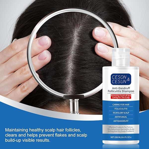 Ceson&Cesun Anti-Fungal/Anti Dandruff 2 in 1 Shampoo for Folliculitis, Scalp Psoriasis & Seborrheic Dermatitis, Itchy & Dry Scalp Relief, Nourishes, Hydrates, Fresh Scent, Safe For Color-Treated Hair - Image 11