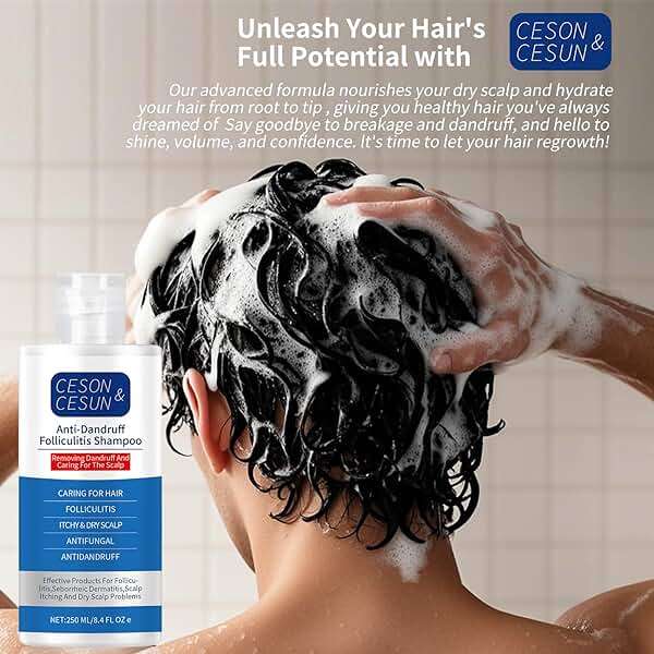 Ceson&Cesun Anti-Fungal/Anti Dandruff 2 in 1 Shampoo for Folliculitis, Scalp Psoriasis & Seborrheic Dermatitis, Itchy & Dry Scalp Relief, Nourishes, Hydrates, Fresh Scent, Safe For Color-Treated Hair - Image 12