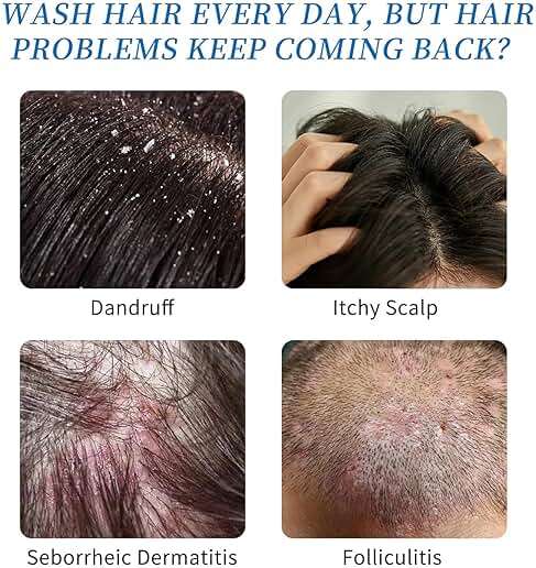 Ceson&Cesun Anti-Fungal/Anti Dandruff 2 in 1 Shampoo for Folliculitis, Scalp Psoriasis & Seborrheic Dermatitis, Itchy & Dry Scalp Relief, Nourishes, Hydrates, Fresh Scent, Safe For Color-Treated Hair - Image 4