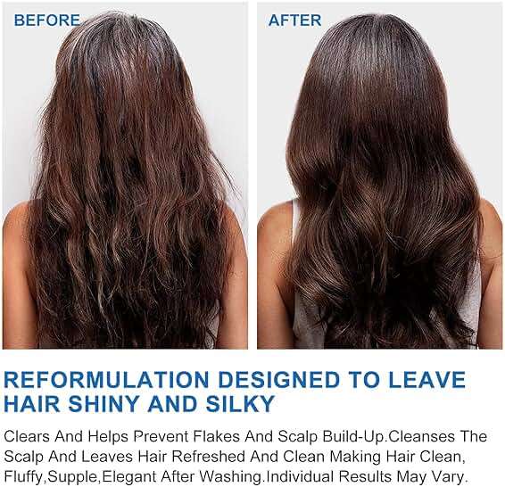 Ceson&Cesun Anti-Fungal/Anti Dandruff 2 in 1 Shampoo for Folliculitis, Scalp Psoriasis & Seborrheic Dermatitis, Itchy & Dry Scalp Relief, Nourishes, Hydrates, Fresh Scent, Safe For Color-Treated Hair - Image 7