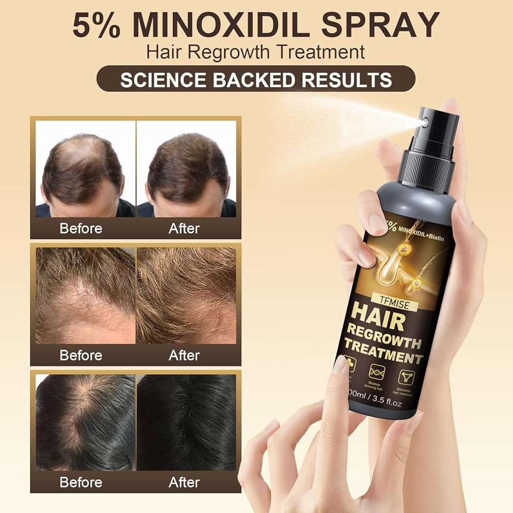 Minoxidil Spray - 5% Minoxidil for Men, Minoxidil for Women Hair Growth Products, Extra Strength Hair Regrowth Devices with Biotin, Help to Stop Loss Hair Unscented Light and non Greasy 3.38 Fl.OZ - Image 2
