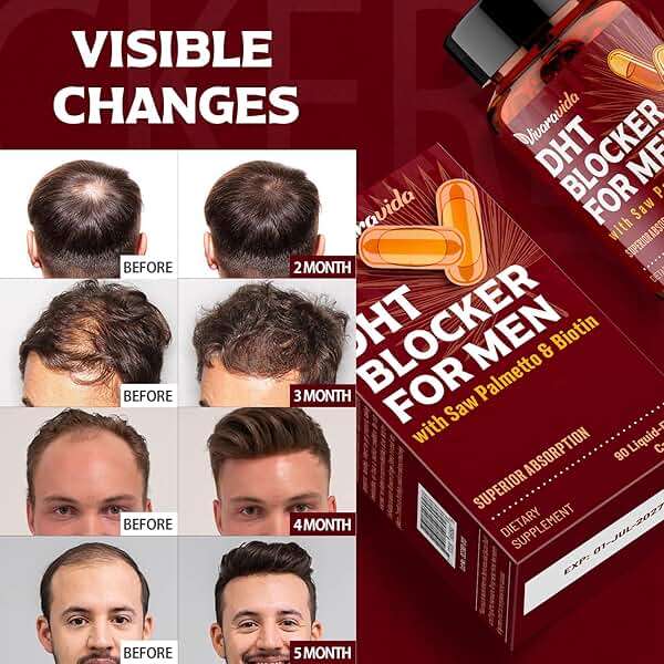 DHT Blocker for Men | Hair Growth Supplement with Saw Palmetto & Biotin - Hair Growth Vitamins - Hair Regrowth - Natural Hair Loss Supplements Liquid-Filled - Proprietary Herbal Blends (180 Capsules) - Image 6