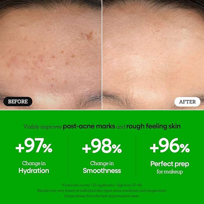 Nature Republic The First Peptide Boosting Serum – Niacinamide, Adenosine, Hydrating & Firming Facial Serum, for Fine Lines & Pores, Korean Skincare, 150ml / 5.07 fl oz - Image 4