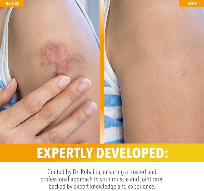 Dr. Robaina Arnica Roll-On 3 oz - Image 4