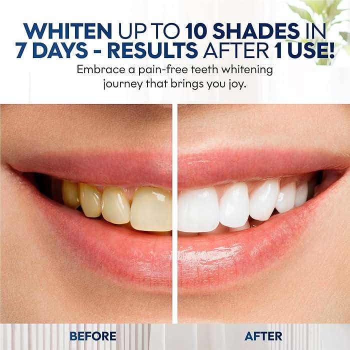 Teeth Whitening Strips | 14 Strips - 7-Day Mint-Flavored Treatments for Sensitive Teeth | Non-Toxic Whitening Strips | Enamel Safe & Peroxide-Free | Removes Stains in 7 Days | Teeth Whitening - Image 5