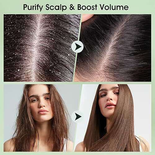 VOERUY Scalp Scrub, Tea Tree Scalp Exfoliator Scrub Shampoo, 2-in-1 Scalp Treatment with Mint Oil, Hair Treatment to Clarify and Remove Build up with Silicone Scalp Massager, 10.6oz/300g - Image 4