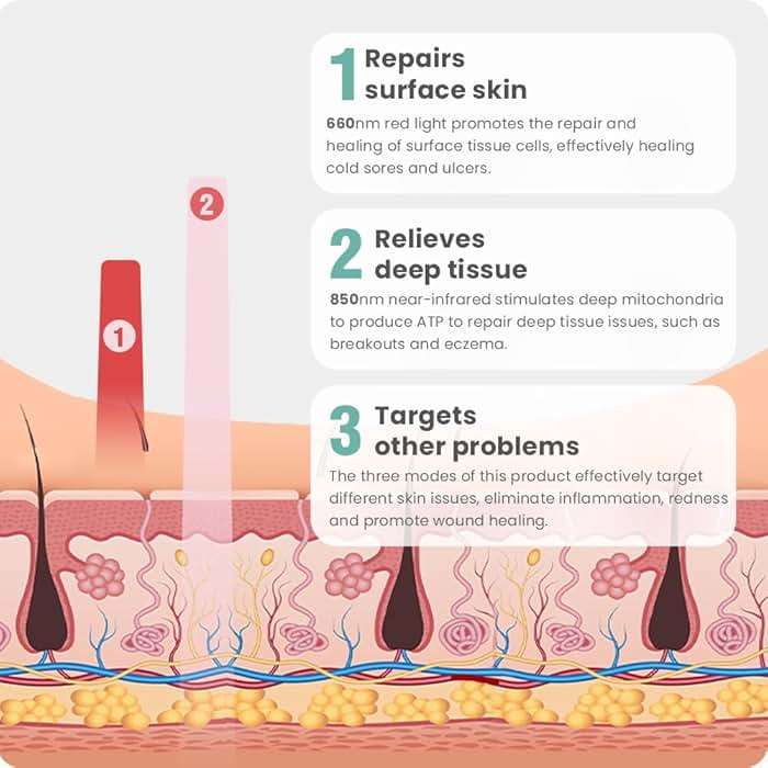 Red Light Therapy for Face, Cold Sore Device Red Light Therapy Wand, FSA-HSA Rechargeable Elite Grade Infrared Light Therapy, Red Light Therapy Cold Sore Device, Ideal for Lips, Skin, Face. - Image 5