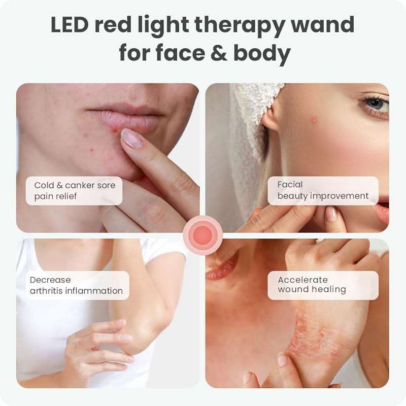 Red Light Therapy for Face, Cold Sore Device Red Light Therapy Wand, FSA-HSA Rechargeable Elite Grade Infrared Light Therapy, Red Light Therapy Cold Sore Device, Ideal for Lips, Skin, Face. - Image 6