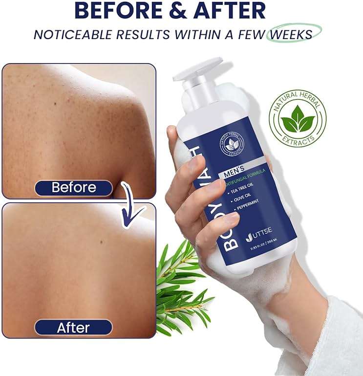 Uttse Tea Tree Body Wash: Antifungal Soap for Men - Eliminates Body Odors & Skin Irritations - 11.8fl oz/350mL - Image 5