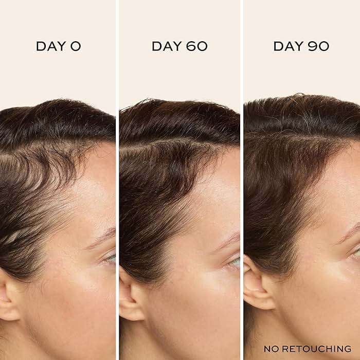 John Frieda ULTRAfiller+ Hair Density Scalp Serum for Fine Hair, Volumizing Hair Serum, Scalp Treatment for Thickening for Women and Men, 2 Oz - Image 3