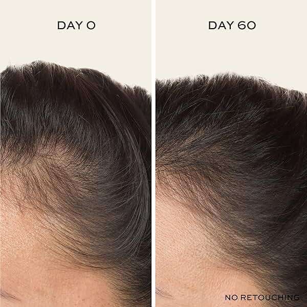 John Frieda ULTRAfiller+ Hair Density Scalp Serum for Fine Hair, Volumizing Hair Serum, Scalp Treatment for Thickening for Women and Men, 2 Oz - Image 6