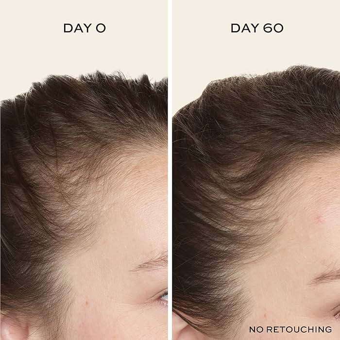 John Frieda ULTRAfiller+ Hair Density Scalp Serum for Fine Hair, Volumizing Hair Serum, Scalp Treatment for Thickening for Women and Men, 2 Oz - Image 7