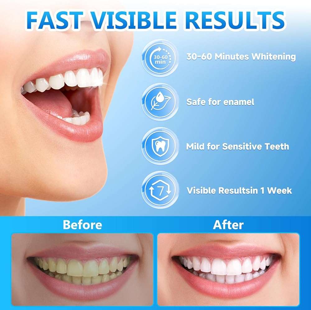 Milumber Teeth Whitening Strips for Sensitive, 42 Strips Whitener Safe Whitestrip, Deep Stains Removal Tooth Whitening, Enamel Safe Non-Slip Dry Strip Technology for Whiter Teeth, Mint - Image 3