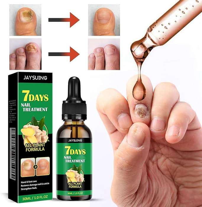 3Pcs Ginger Nail Treatment, 7days Nail Growth Serum Solution, Ginger Cuticle Care Oil for Nails Strengthener, Promote Nail Healthy Grow(30ml) - Image 2
