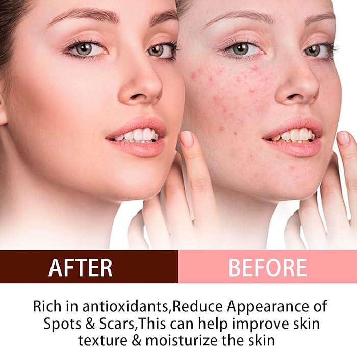Organic Rosehip Seed Oil,Essential Oils for Anti Aging,100% Pure Cold Pressed All Natural,Hair Relaxer & Skin Face Moisturizer - Hydrating and Nourishing Face Oil for All Ages Skin 4.23OZ(120ml) - Image 3