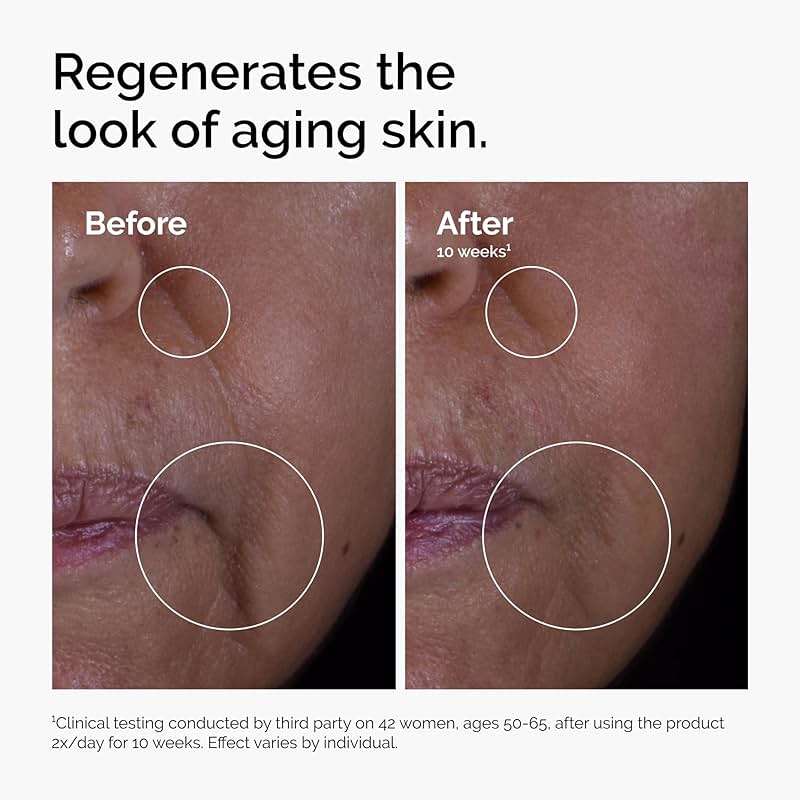 The Ordinary GF 15% Solution, Anti-Aging Formula for Visible Skin & Wrinkle Repair, 1 Fl Oz - Image 4