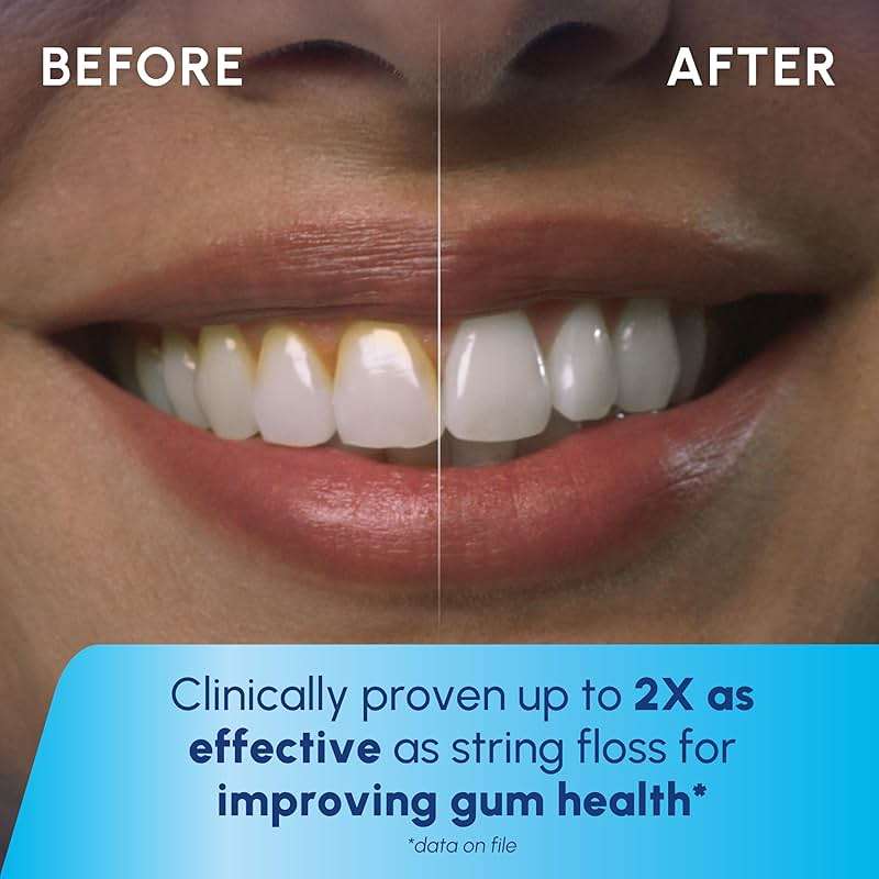 Waterpik Cordless 1100 Rechargeable Portable Water Flosser for Teeth Cleaning and Flossing, Travel, Braces Care, Healthier Gums, Waterproof for Shower, ADA Accepted, WF-30CD White, Packaging May Vary - Image 5