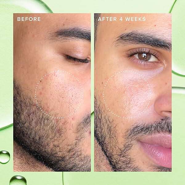 Farmacy 2% Salicylic Acid Toner for Face - Deep Sweep BHA Liquid Exfoliant + Pore Cleaner - Controls Oil, Gently Exfoliates + Refines Pores - Skin Care for Combo, Oily + Blemish-Prone Skin - (10ml) - Image 4