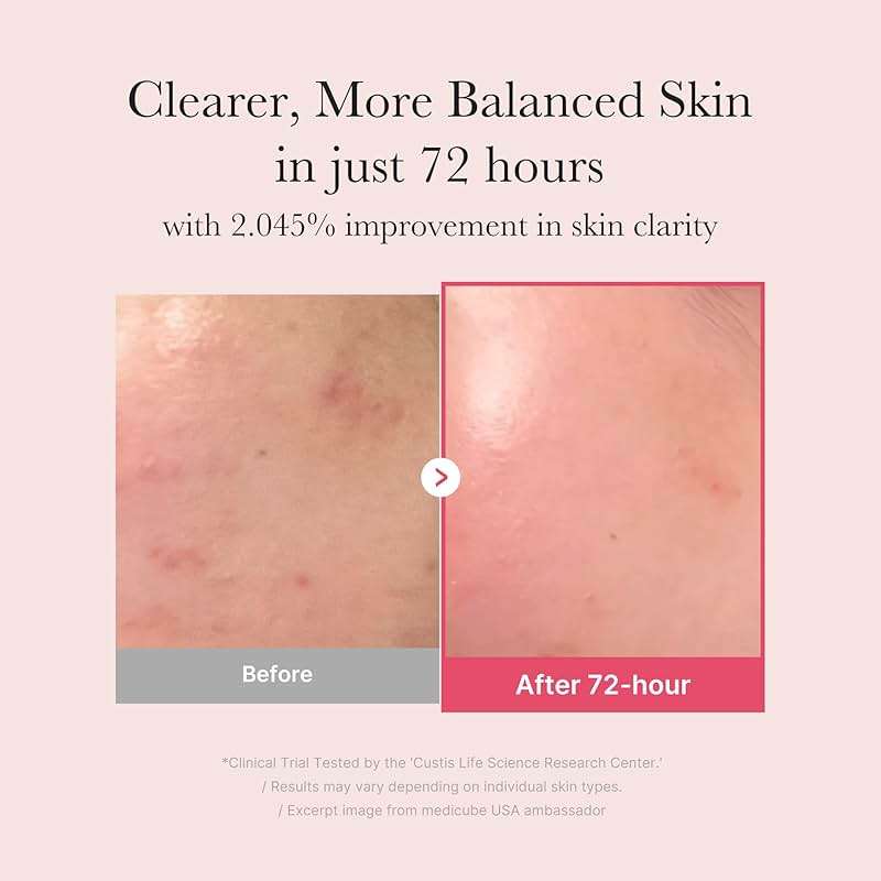 medicube TXA+Niacinamide 15% Glow Facial Serum for After Spot Care | All-in-One Daily Korean Skincare | Uneven Skin Tone, Texture, and Hydration Care | High-Potency Tranexamic Acid 5% | 1.01 fl.oz - Image 3