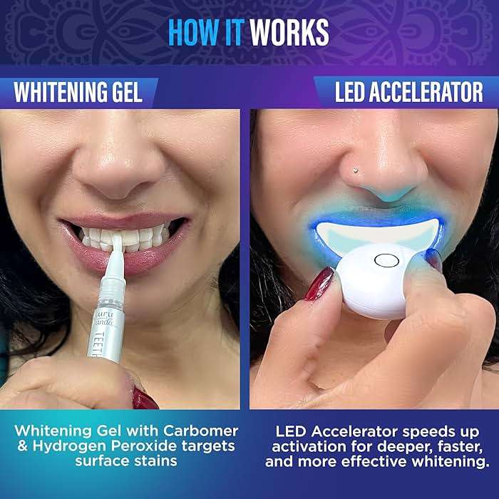 GuruNanda Teeth Whitening Kit - 8% Hydrogen Peroxide Teeth Whitening Gel Pen & Advanced Wireless LED Accelerator Light, Upto 10 Shades Whiter Teeth, Professional Dentist-Inspired System, 40 Treatments - Image 3