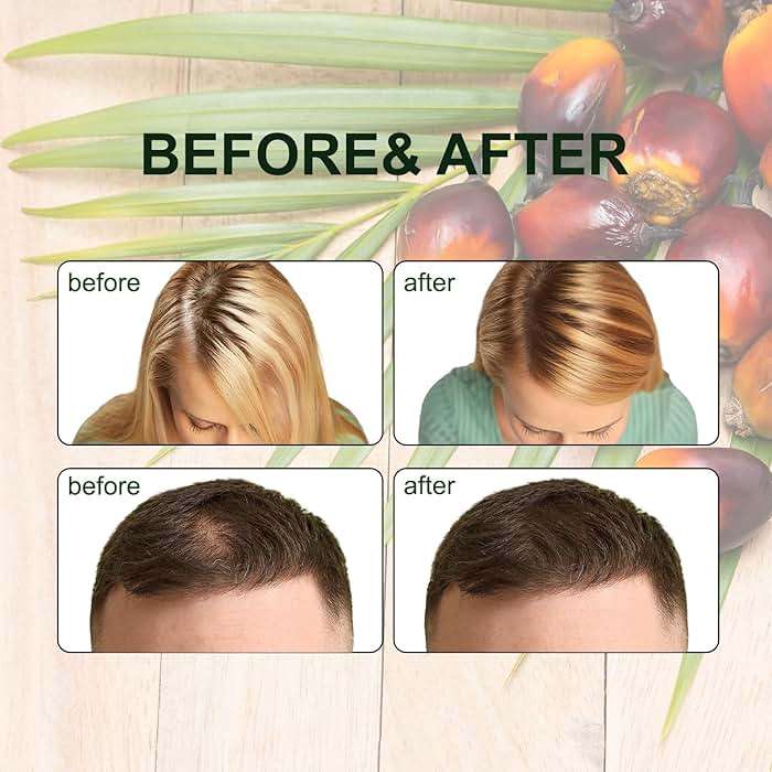 Batana Oil for Hair Growth, Dr Sebi Organic Raw Batana Oil, Enhances Hair Thickness, Prevents Hair Loss for Men and Women 120ml. - Image 5