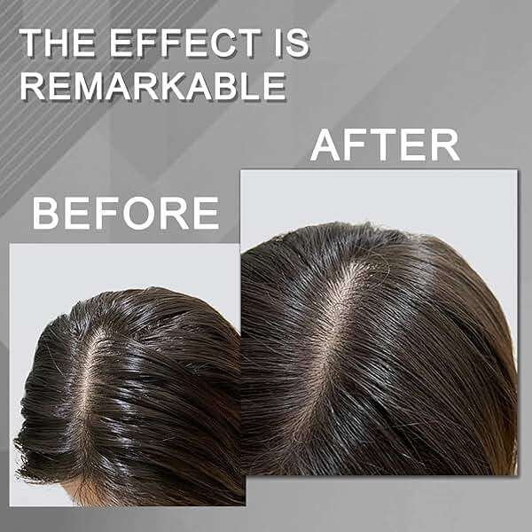 BENIX Dry Shampoo for Women & Men- Volumizing Spray for All Hair | Invisible Formula, Instantly Fresh & No White Residue | Natural Dry Shampoo Powder with Rice Starch (5 Oz) - Image 3