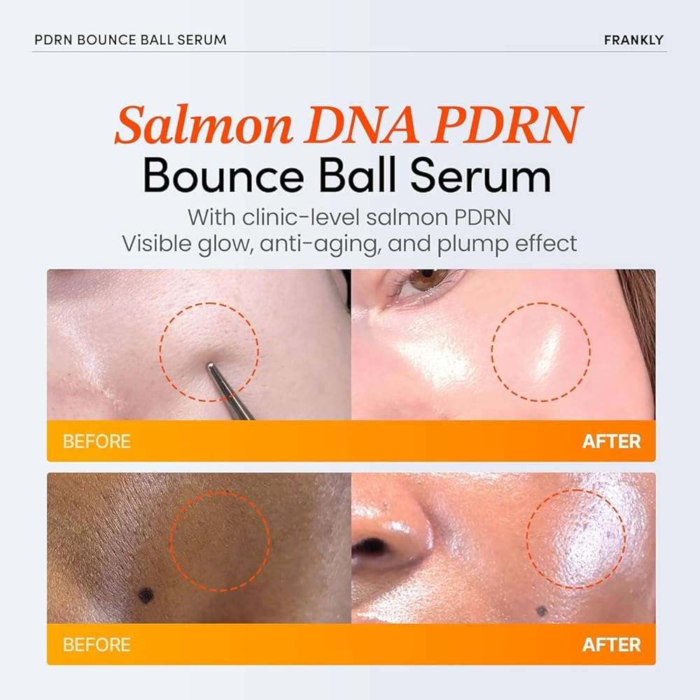 FRANKLY Salmon PDRN Bounce Ball Serum – 99% Pure Salmon DNA PDRN for Post Microneedling Recovery, Redness & Damaged Skin Repair | Glass Skin Korean Skincare | Lightweight, Non Sticky | 1.01 fl oz - Image 3