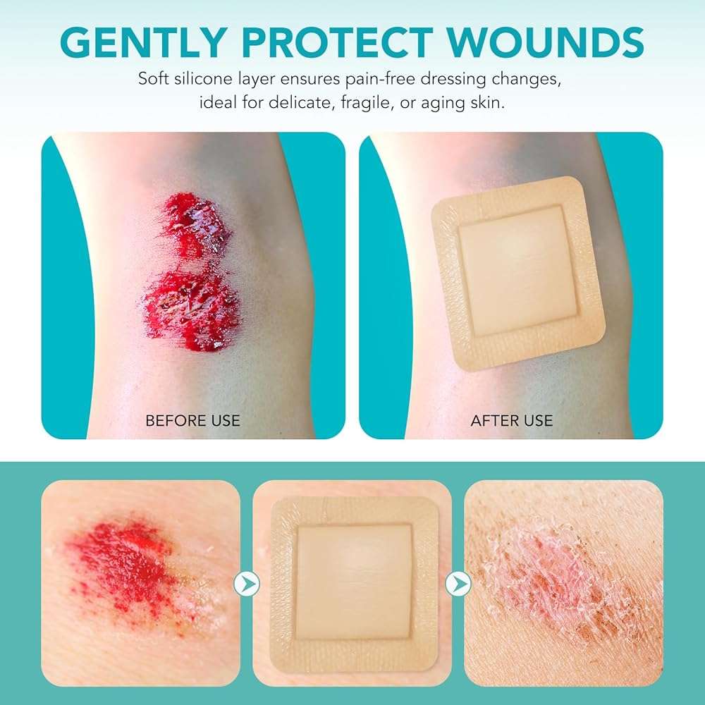 Silicone Foam Dressing, Wound Dressing Pads Various - 5 Packs for Protection from Infection, Hypoallergenic, Breathable, Absorbent for Cuts, Grazes, Ulcers, Sores -10cm x 10cm - Image 5