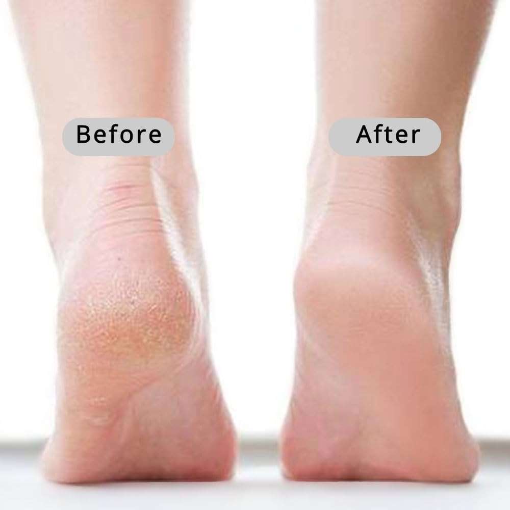 CopesFuda Curved Handle -13.7" Pumice Stone - Ergonomic Non-Slip Foot Scrubber for Shower - Easy Reach Callus Remover & Pedicure Tool for Cracked Heels & Smooth Feet - Image 5