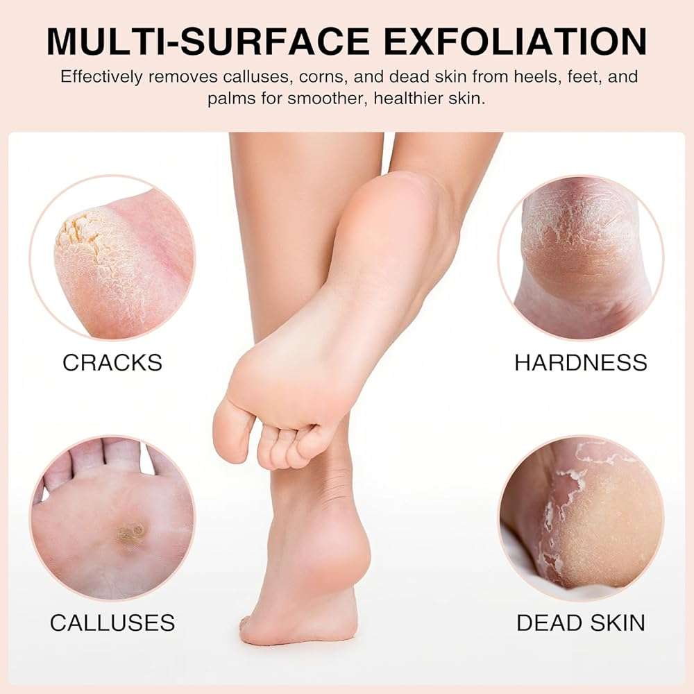 Natural Pumice Stone Set - 3-Pack Oval-Shaped Volcanic Lava Foot Scrubber Files for Callus, Corn, Cracked Heel, and Dead Skin Exfoliation, 4 x 2.8 x 1.6 Inches - Image 2