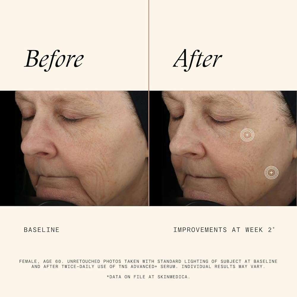 SkinMedica TNS Advanced+ Face Serum - Multi Peptide Serum to Help Improve the Appearance of Wrinkles, Fine Lines, Skin Tone & Texture (1 oz) - Image 4