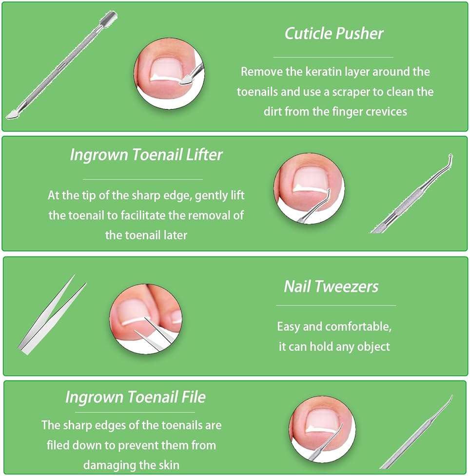 Ingrown Toenail Corrector Set, Professional Foot Care Kit for Ingrown Toenail Treatment & Removal, Toenail Straightener for Curved Pincer Thick Nails, Home Pedicure Tools for Men Women - Image 6
